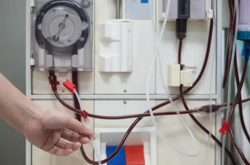 mano di un operatore che sistema la macchina per la dialisi