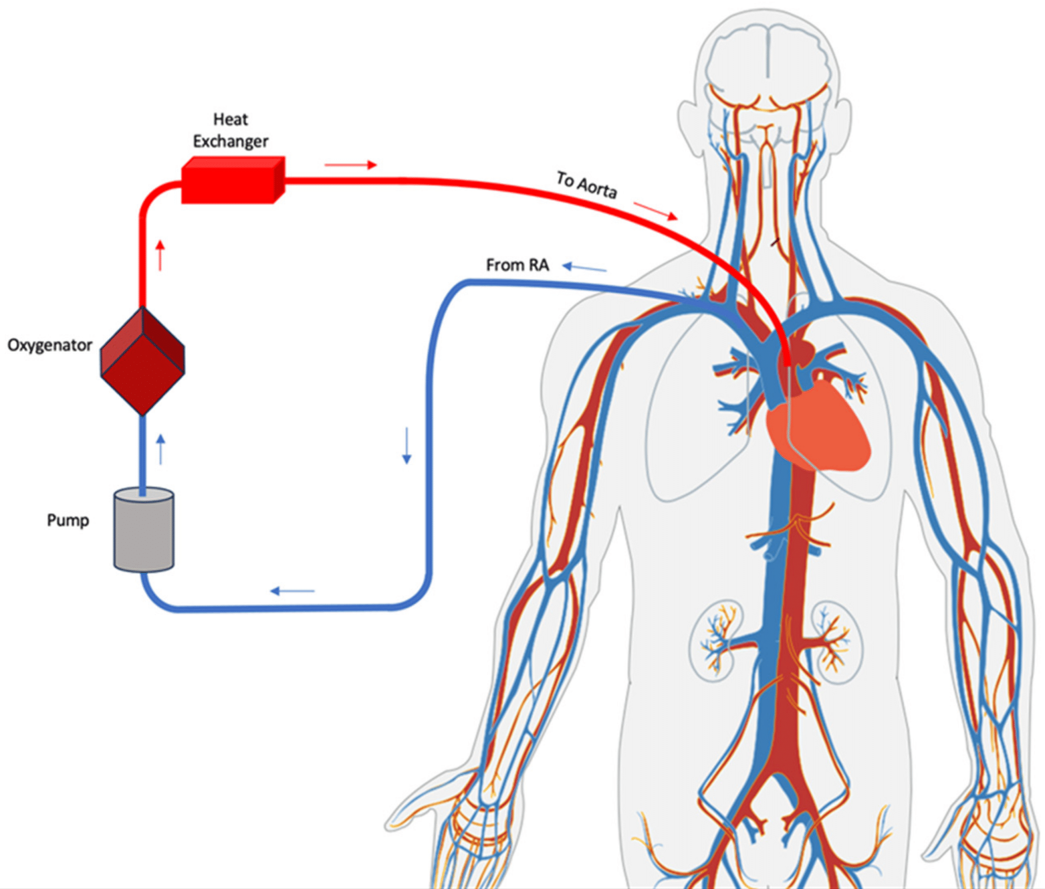 Valora Machine Trasporto ECMO Milano - Fornitura di Assistenza Medica Specializzata